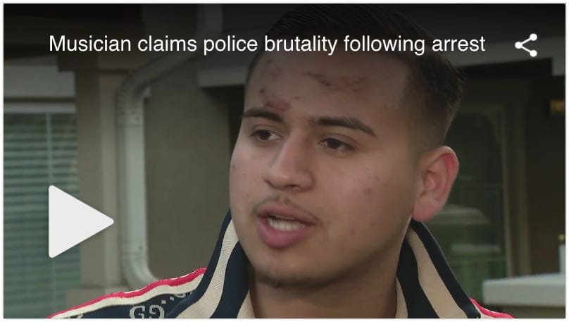 Popular Musician Claims Police Brutality Following House Party Arrest In San Bernardino